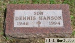 Dennis Hanson