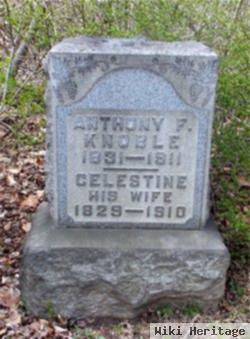 Anthony F Knoble