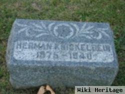 Herman Knickelbein