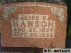 Jesse R Hanson