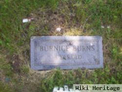 Burnice Burns