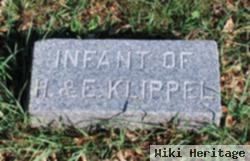 Infant Klippel