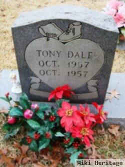 Tony Dale