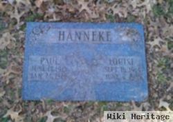 Paul J Hanneke